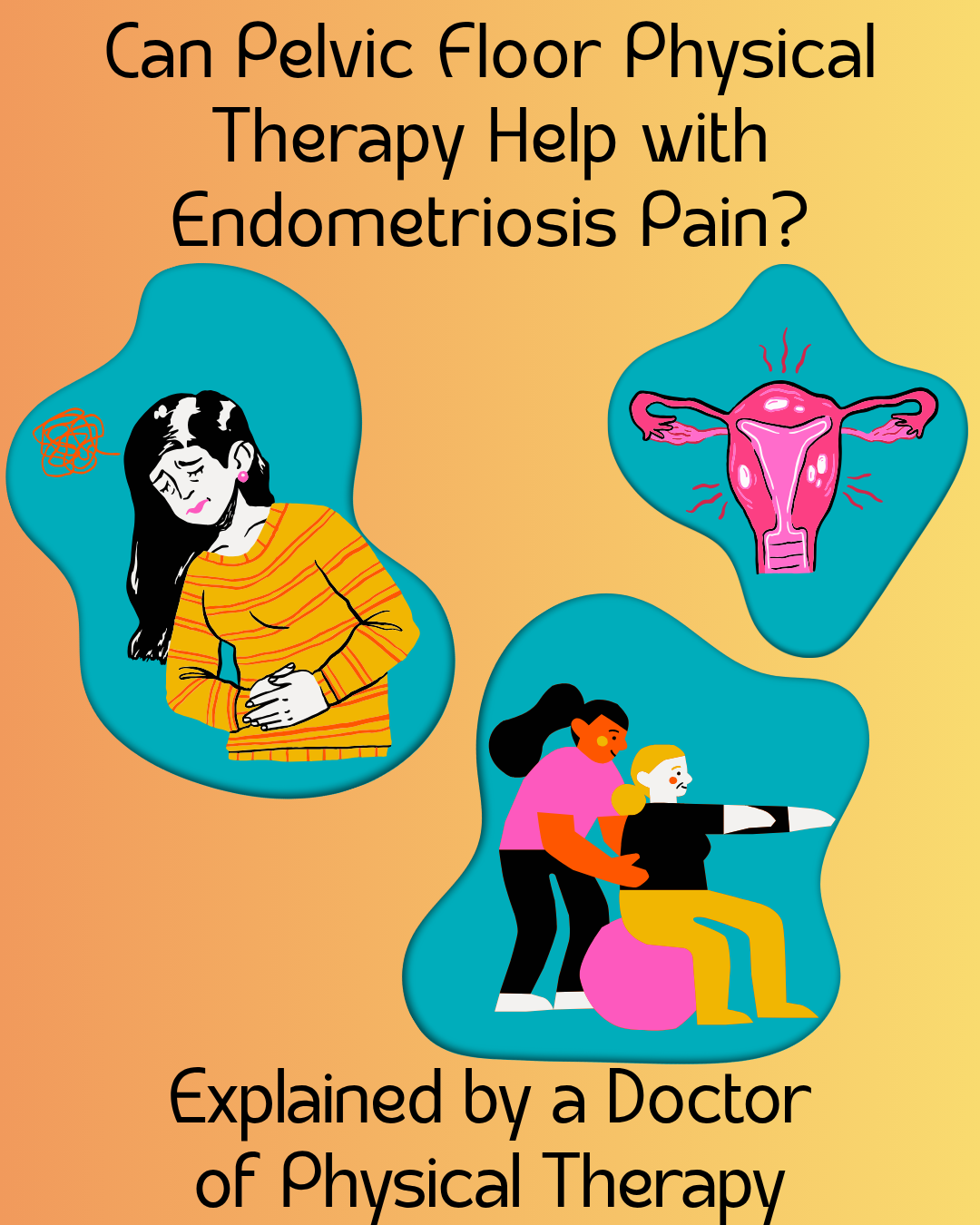 Can Pelvic Floor Physical Therapy Help with Endometriosis Pain? Explained by a Doctor of Physical Therapy